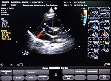 Echocardiogram (Cardiac Ultrasound)