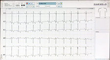 Electrocardiography (ECG or EKG)