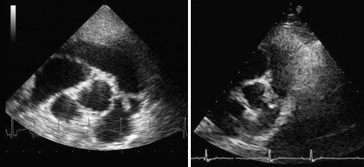 Pulmonic Stenosis - Sawgrass Veterinary Cardiologysawgrass Veterinary 