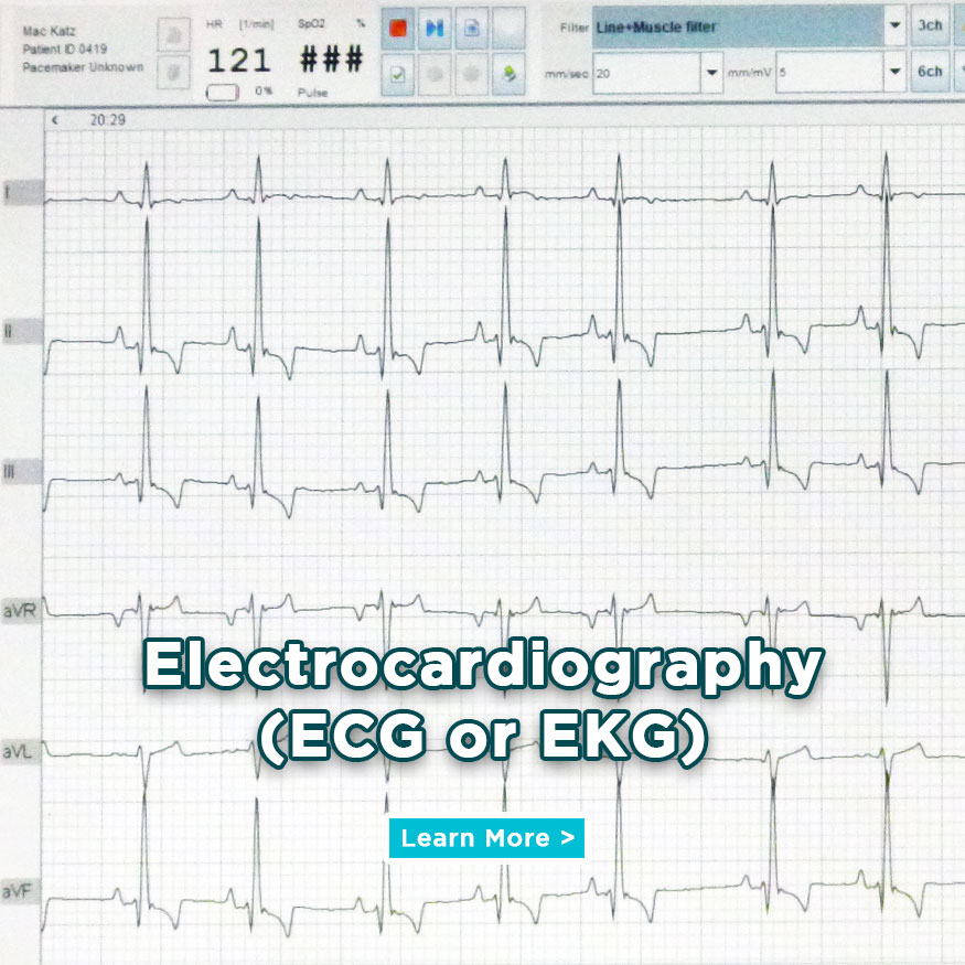 See Our Electrocardiography Services